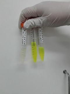 Proteiinpuhdistusta